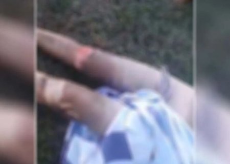 Mulher tem corpo incendiado em tentativa de feminicídio em fazenda no Pantanal